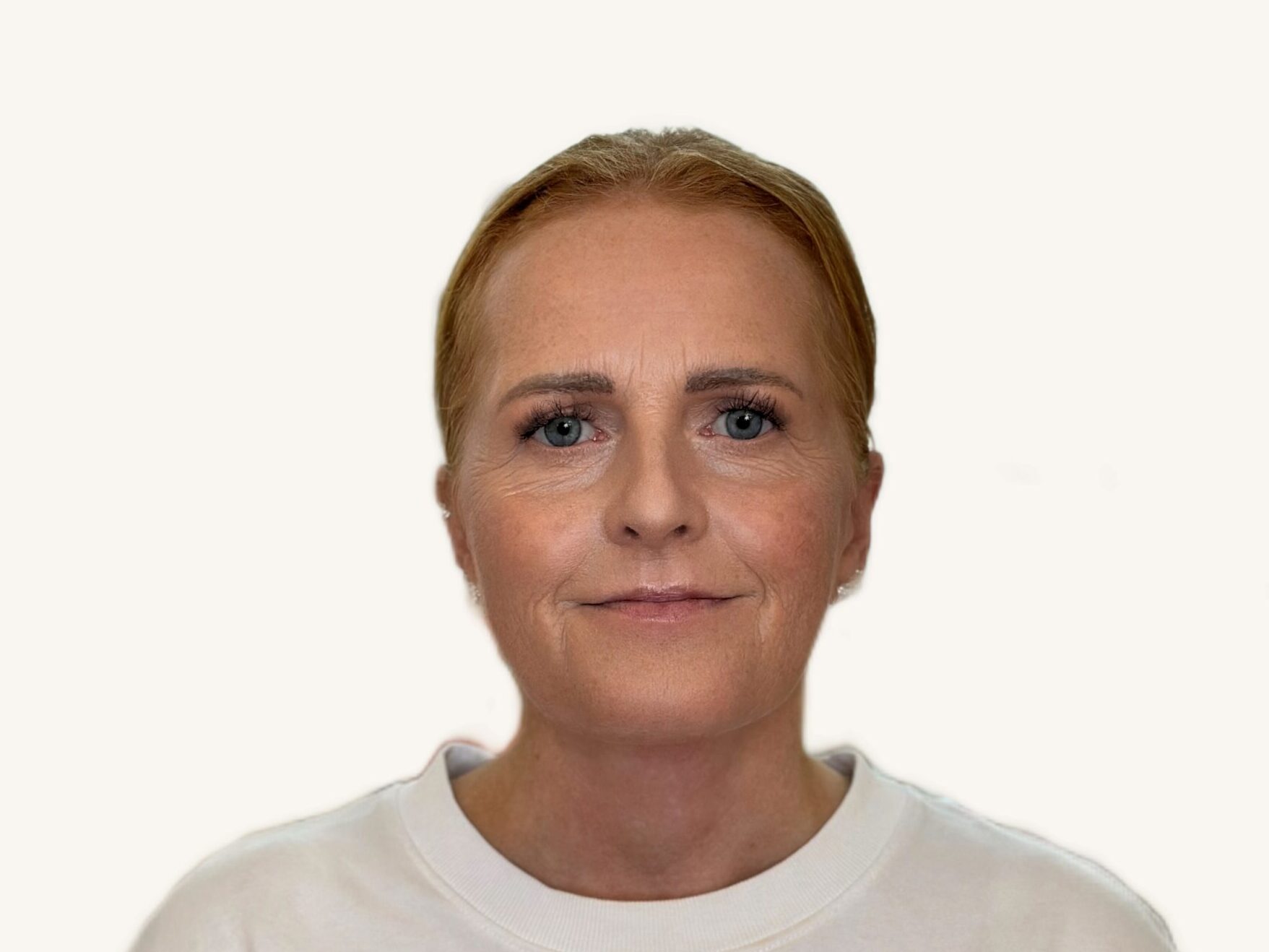 Therese Andersson